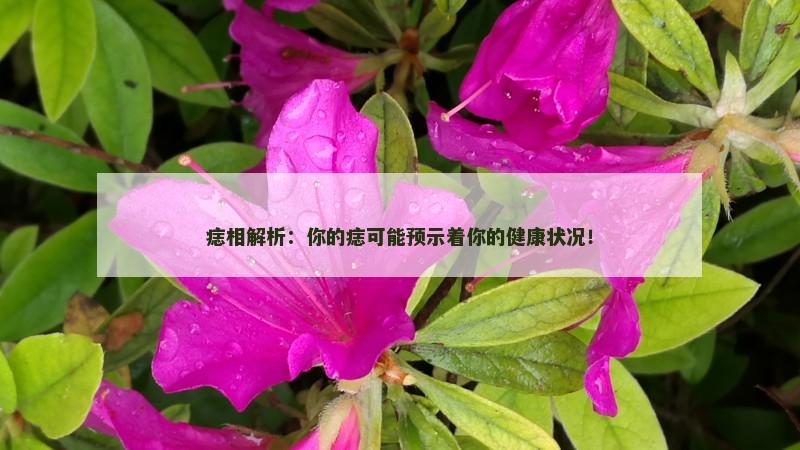 痣相解析：你的痣可能预示着你的健康状况！